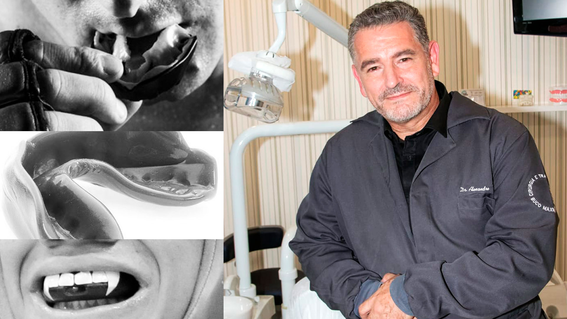 Alexandre Barberini - o que é odontologia desportiva